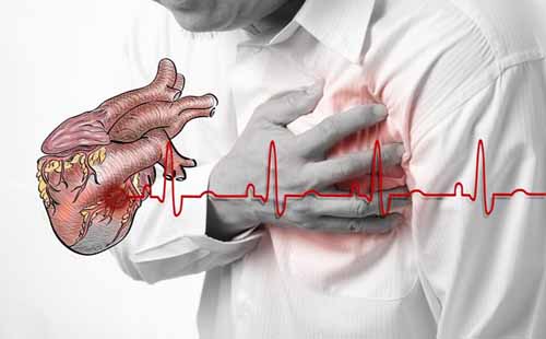 Dapoxetine chống chỉ định với những người bị bệnh lý tim mạch mãn tính