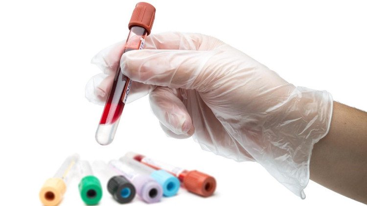 Xuất huyết viêm bàng quang trẻ em cần xét nghiệm máu để tìm ra nguyên nhân