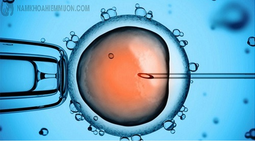 Thụ tinh nhân tạo là cách bơm tinh trùng vào tử cung người vợ tăng khả năng thụ thai