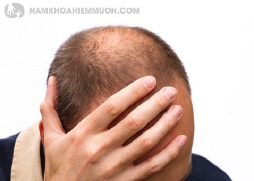 Thận yếu gây rụng tóc – nguyên nhân do đâu?
